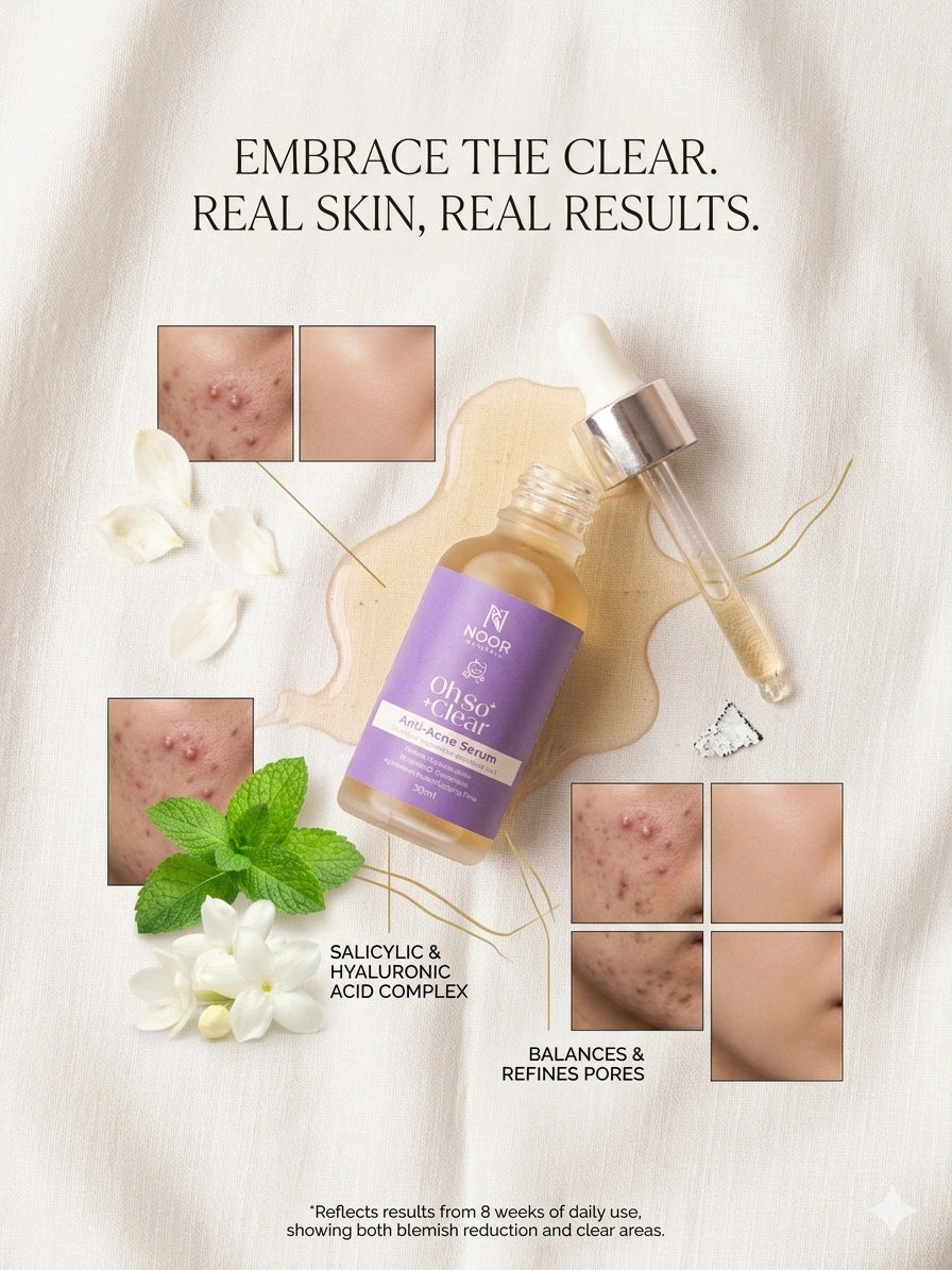 Oh So Clear Anti Acne Serum